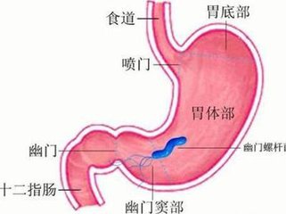 胃癌晚期最新治疗方案概览